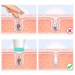 Glow Brush- szczoteczka do domowej pielęgnacji twarzy