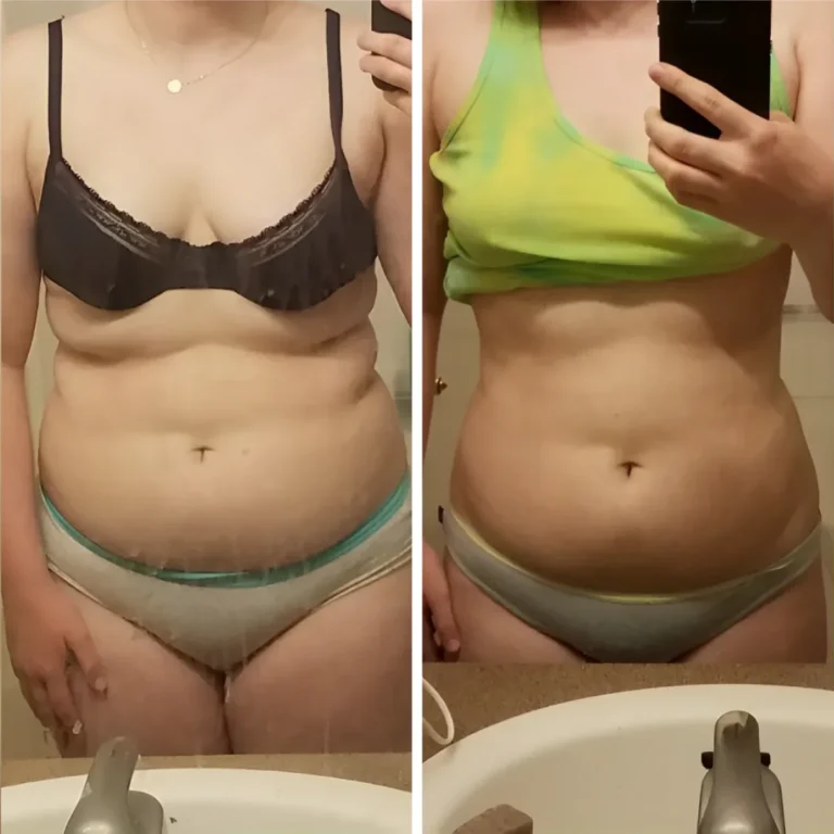 VS-Before-and-after-2-768×768