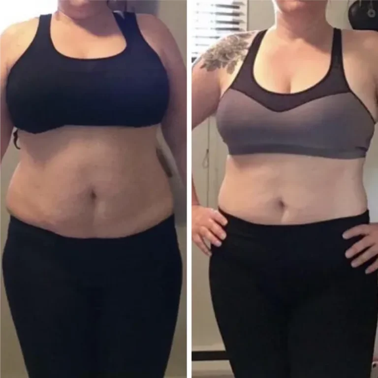 VS-Before-and-after-3-768×768